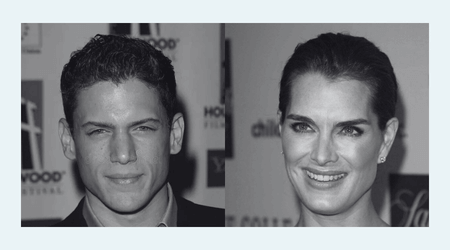 widow's peak gyvanašlės plaukų augimo linija